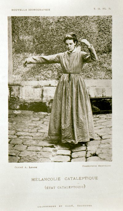 1889年にパリで出版されたジャンマルタンシャルコー教授（1825-93）の「ヌーベルイコノグラフィエデラサルペトリエール」のカタロプシーの憂鬱 作： Albert Londe